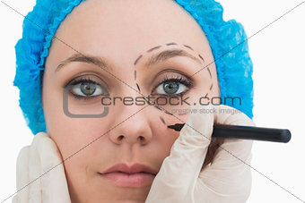 Plastic surgeon drawing around eye