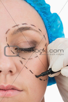 Plastic surgeon writing in the woman face
