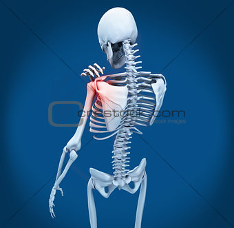 Shoulder pain on skeleton