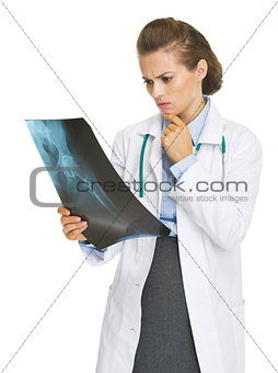 Thoughtful doctor woman looking on fluorography