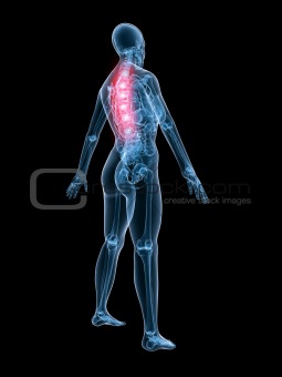 x-ray anatomy-backache