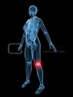 x-ray anatomy-painful knee