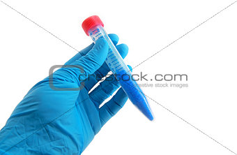 arm in glove with laboratory tube