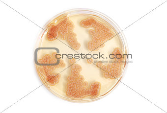 fungi on agar plate in laboratory
