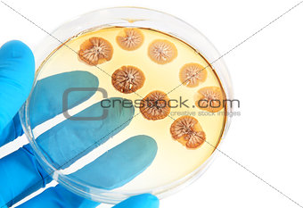 fungi microorganisms on agar plate in laboratory