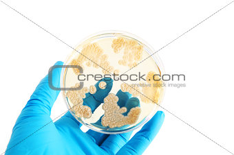 fungi microorganisms on agar plate