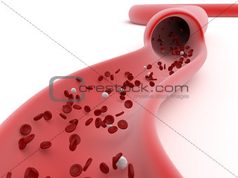 View of a sliced open blood vessel