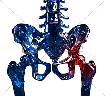 Glass skeleton 3D hip pain concept