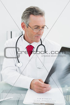 Doctor looking at x-ray picture of lungs in office