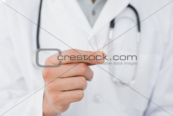 Mid section of a male doctor holding acupuncture needles