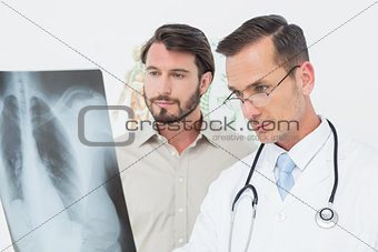 Male doctor explaining lungs x-ray to patient
