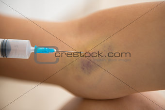Closeup on drug addict young woman making injection