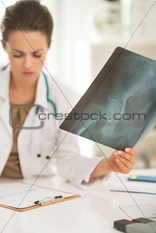 Closeup on medical doctor woman with fluorography working in off