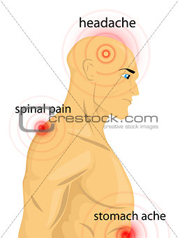 Human body with pain dots