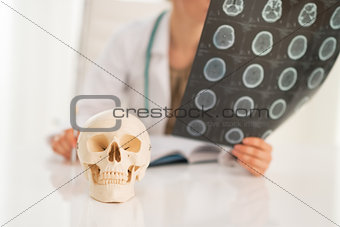 Closeup on human skull and medical doctor woman with fluorograph