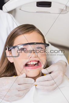 Dentist putting mouth retractor on little girl