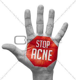 Stop Acne Sign Painted, Open Hand Raised.