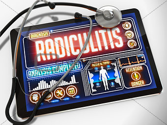 Radiculitis on the Medical Tablet.