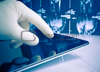 hand in medical blue glove touching modern digital tablet on x-ray images background