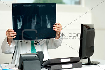 Male surgeon holding x-ray