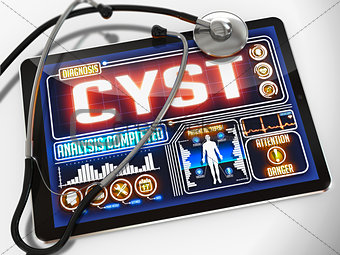 Cyst on the Display of Medical Tablet.