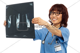 Female doctor reviewing x-ray report