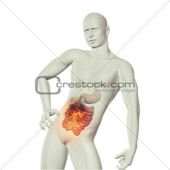 3D male medical figure with fire effect in stomach with exposed 
