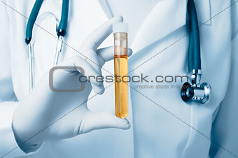 Doctor holding urine sample