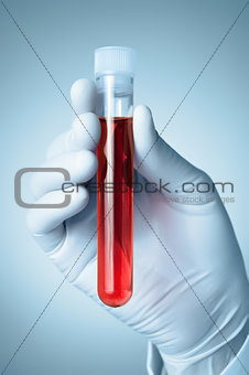 Hand with blood sample