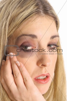 battered woman with a black eye isolated on white