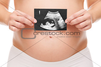 Pregnant woman holding an untrasound scan