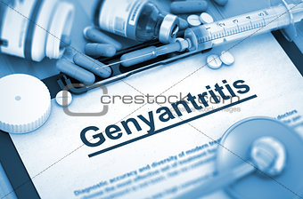 Genyantritis. Medical Concept.