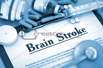 Brain Stroke Diagnosis. Medical Concept. 