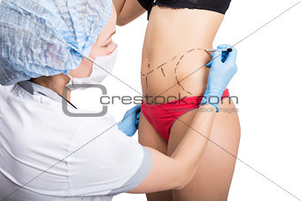 Female doctor makes dotted line on female body for cellulite correction. cosmetic surgery. lifting and breast augmentation