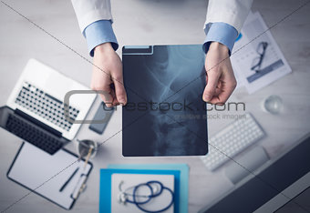 Radiologist checking an x-ray image