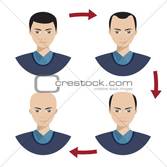 Four stages of hair loss for men.