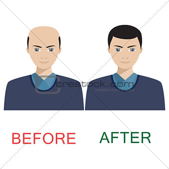 Man before and after hair treatment.