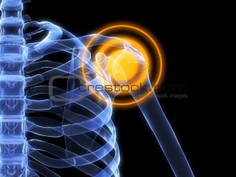 x-ray shoulder inflammation