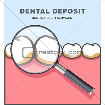 Dental deposit - row of tooth under magnifying glass