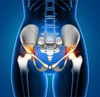 3D medical female showing pain in hip joints