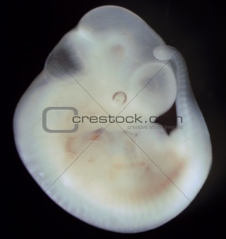 Mouse embryo, day 11 of development