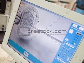 Monitor showing intra cytoplasmic sperm injection