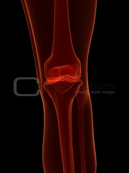 x-ray - skeletal knee
